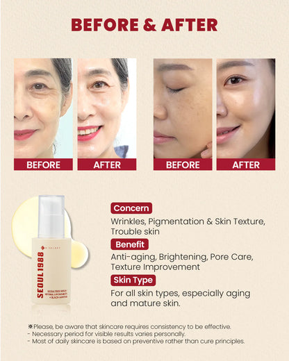 K Secret Seoul 1988 Serum : Retinal Liposome 2%+Black Ginseng 30ml